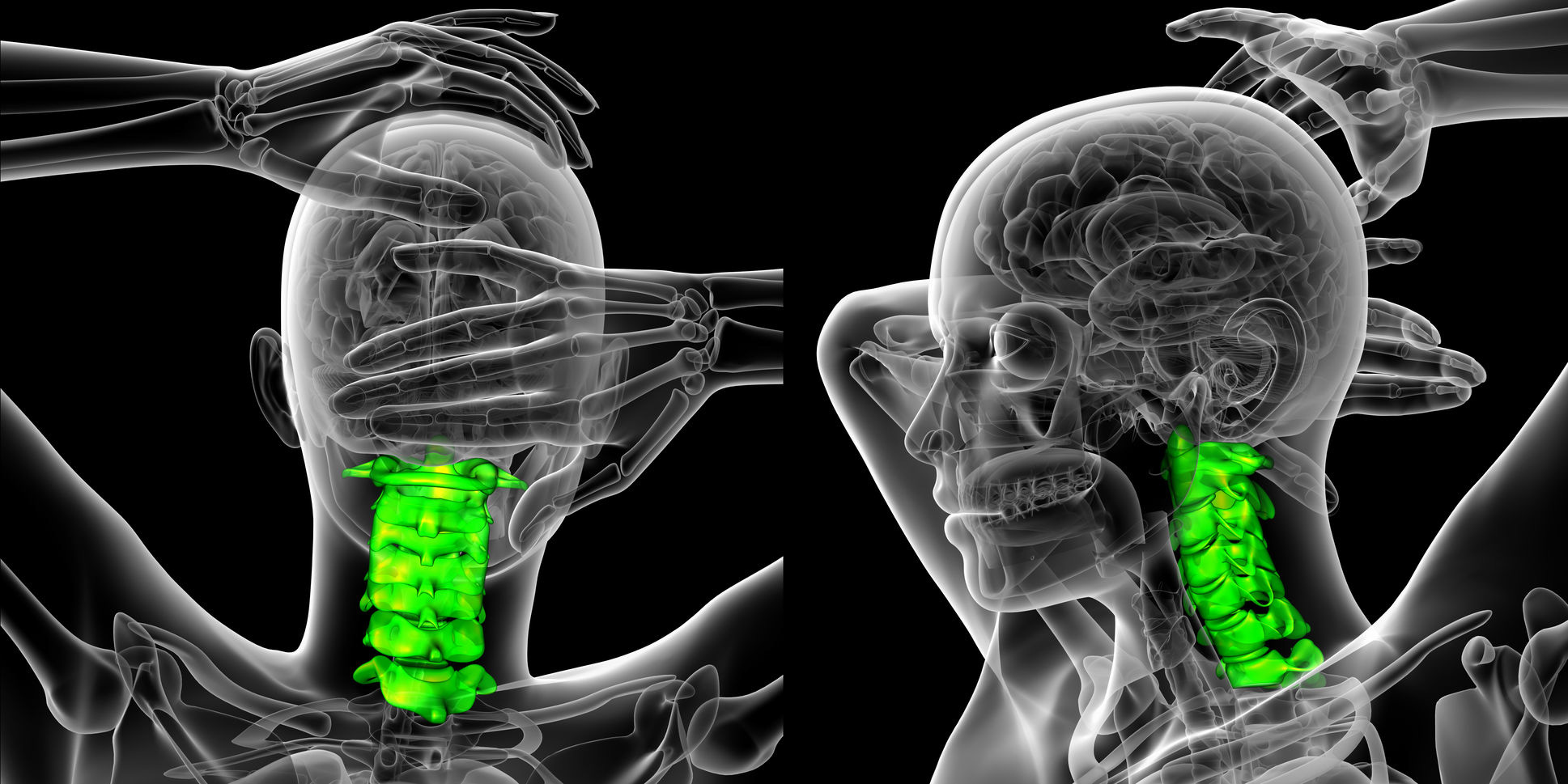 Lower Cervical Spine Anatomy And Disorders - What Are They? 